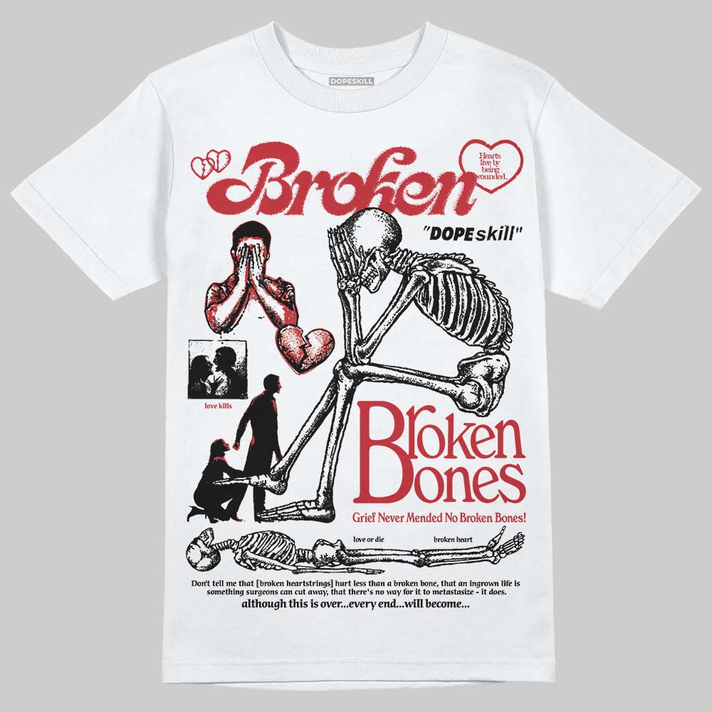 Ruby 1s superstreetwear T-Shirt Broken Bones Graphic