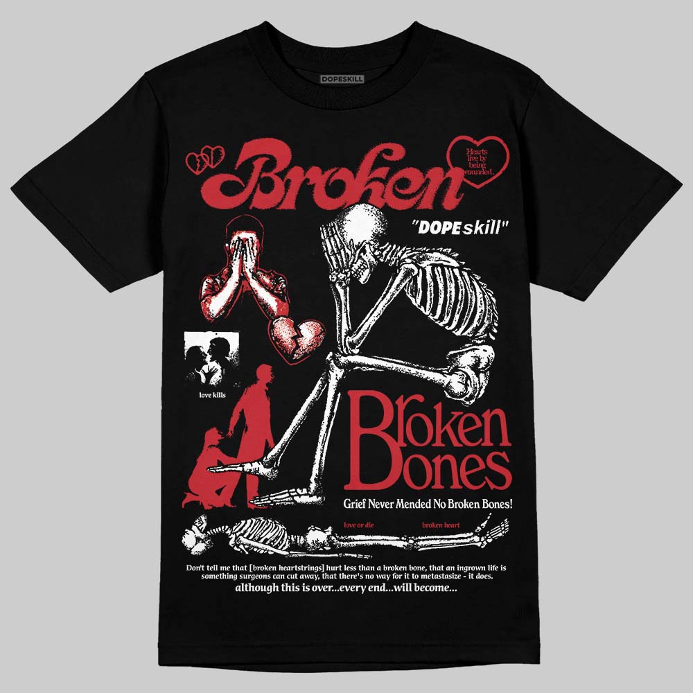 Ruby 1s superstreetwear T-Shirt Broken Bones Graphic
